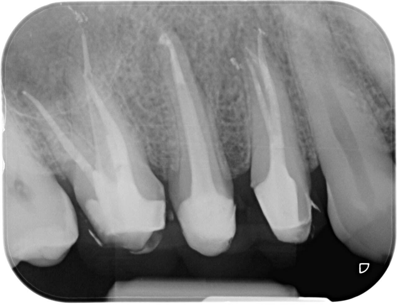 Advanced Endodontics course photo 1
