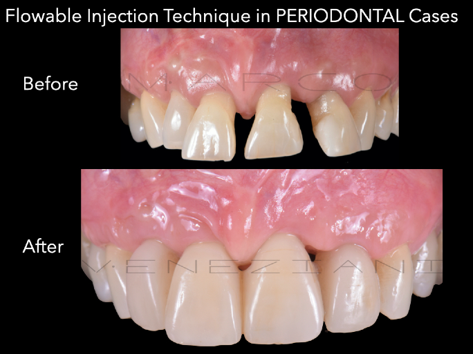 Before and after a periodontal case shown in the original course brochure
